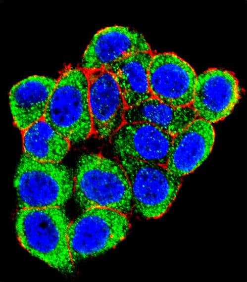PML Antibody (aa470-499)