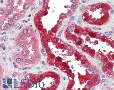 IHC-plus™ SLC34A1 / NPT2 Antibody