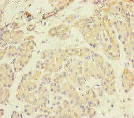 Polyclonal Rabbit anti-Human P2RX3 / P2X3 Antibody (IHC, WB)