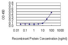 BGN / Biglycan Antibody (clone 4E1-1G7)