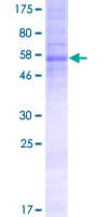 Human TMEM110 Protein (Recombinant GST)
