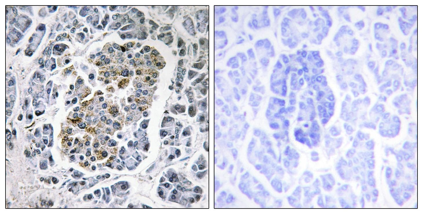 Polyclonal Rabbit anti-Human SSBP1 / mtSSB Antibody (IHC, IF, WB)