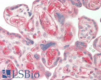 Polyclonal Rabbit anti-Human AFM / Afamin Antibody (aa22-210, IHC, WB)