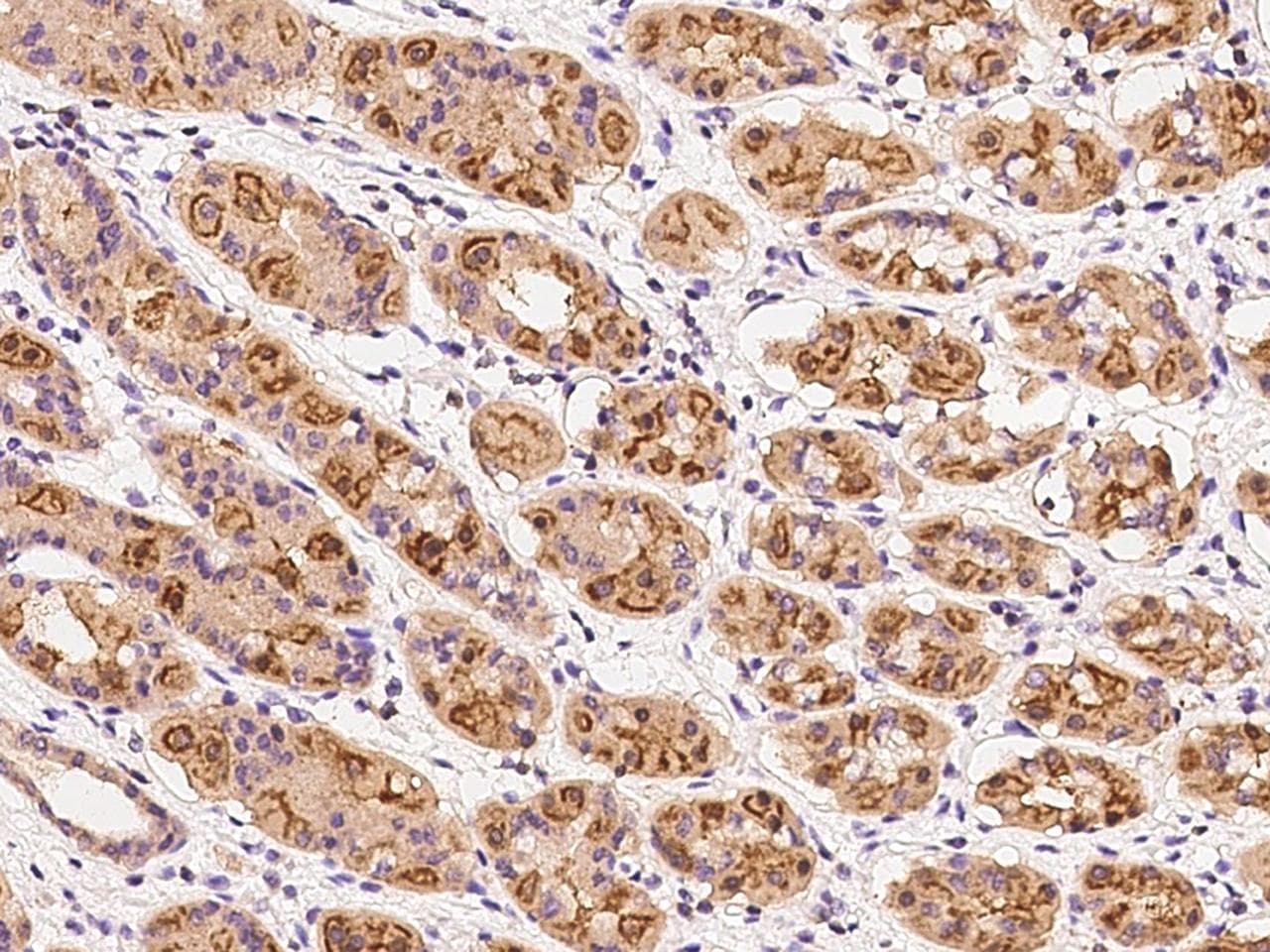 Polyclonal Rabbit anti-Human DENND2D Antibody (IHC)