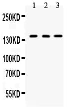CML / BCR Antibody