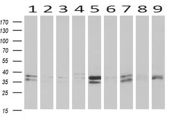 MAPRE2 / EB2 Antibody (clone OTI1A3)