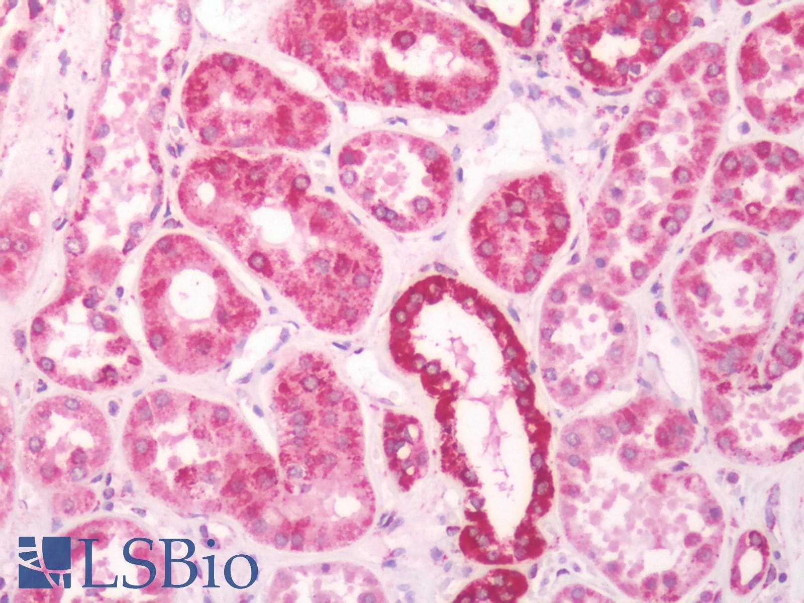 IHC-plus™ DECR1 Antibody (aa1-335)