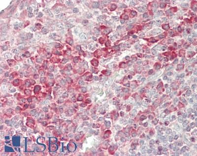IHC-plus™ Polyclonal Rabbit anti-Human OGG1 Antibody (IHC, WB)