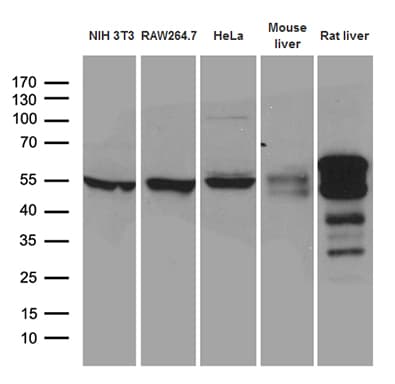 TRXR1 / TXNRD1 Antibody (clone OTI5G3)