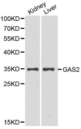 GAS2 Antibody