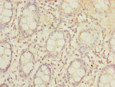 Polyclonal Rabbit anti-Human SLC23A2 / SVCT2 Antibody (IHC, WB)