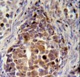 Polyclonal Rabbit anti-Human RDH16 Antibody (aa3-31, IHC, WB)