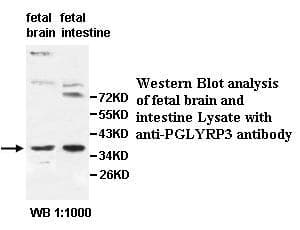 Polyclonal Rabbit anti-Human PGLYRP3 Antibody (aa45-288, WB)