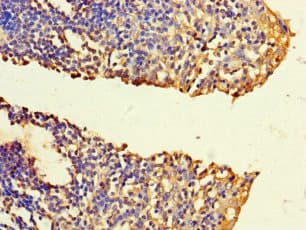Polyclonal Rabbit anti-Human FNTB Antibody