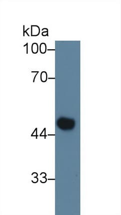 F10 / Factor X Antibody (aa21-481)