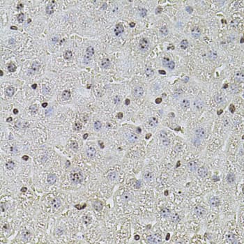 POT1 Antibody