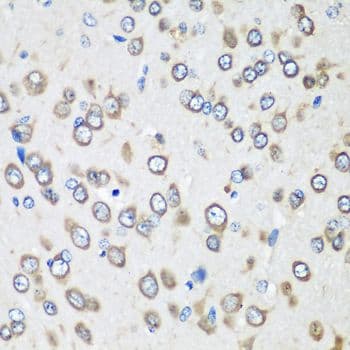 EF1G / EEF1G Antibody