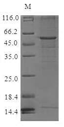 Human CCR6 Protein (Recombinant 6His-SUMO, N-terminus)