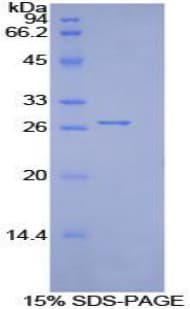 Mouse ITGB2 / CD18 Protein (Recombinant His-T7)