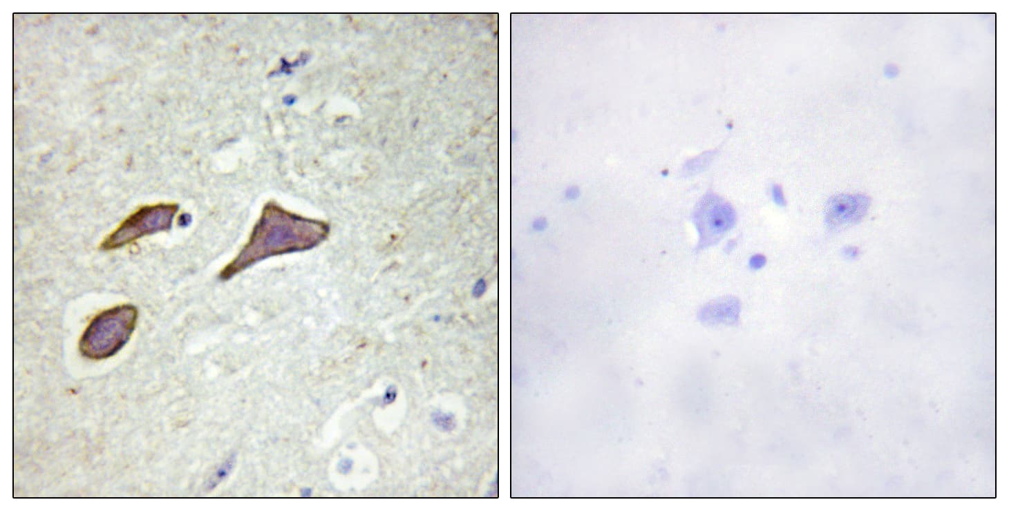 Polyclonal Rabbit anti-Human SCNN1B / ENaC Beta Antibody (phospho-Thr615, IHC, IF, WB)