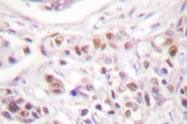 RAD17 Antibody (Ala639)