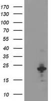 TP73-AS1 / KIAA0495 Antibody (clone OTI2B9)