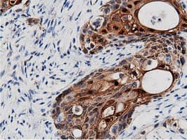 AK5 / Adenylate Kinase 5 Antibody (clone OTI2F9)