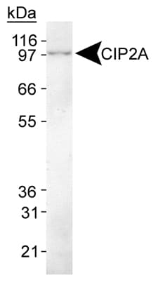 KIAA1524 / p90 Autoantigen Antibody (C-Terminus, clone 2G10, DY650)