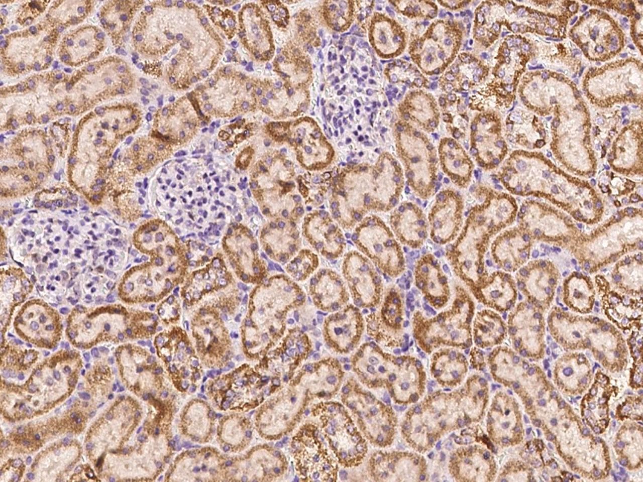 Polyclonal Rabbit anti-Rat ADAM10 Antibody (Preservative Free, IHC)