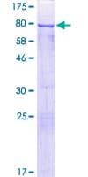 Human CRNN / Cornulin Protein (Recombinant GST)