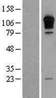 RGS3 Protein (Over-Expression Lysate Myc-DDK (Flag))