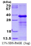 Human SERTAD1 / TRIP-Br1 / SEI-1 Protein (Recombinant His)