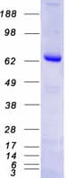 Human PARP3 Protein (Recombinant Myc-DDK (Flag))
