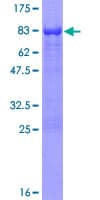 Human AAK1 Protein (Recombinant GST)