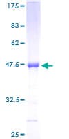 Human TIMP2 Protein (Recombinant GST)