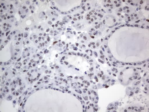 RBFOX1 / A2BP1 Antibody (aa1-210, clone OTI4F9)