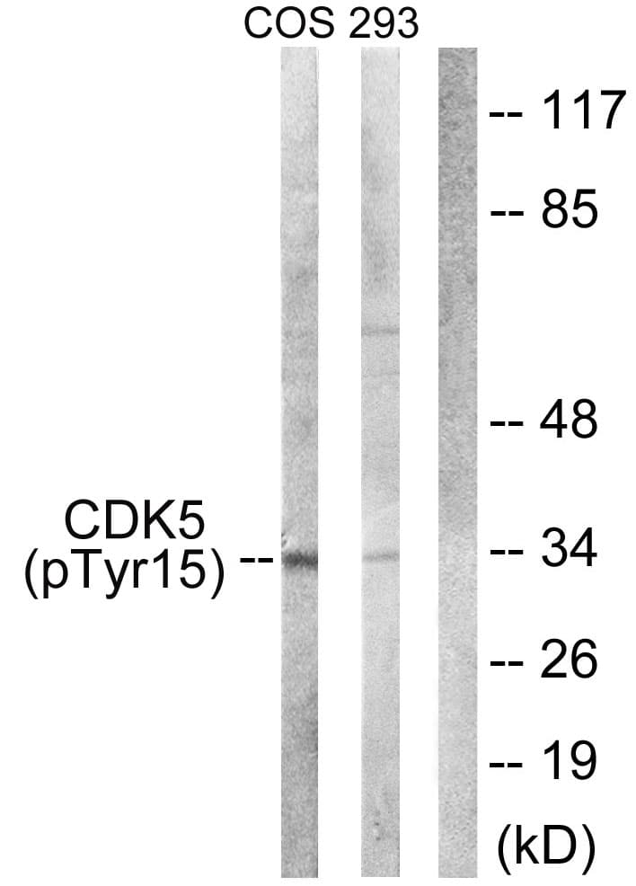 CDK5 Antibody (phospho-Tyr15)