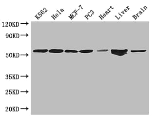 ETS2 Antibody