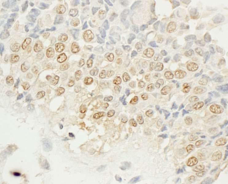NEK4 Antibody (aa475-525)