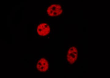 CEBPZ / CBF Antibody