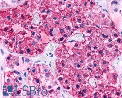 IHC-plus™ Polyclonal Rabbit anti-Human CRHR2 / CRF2 Receptor Antibody (N-Terminus, IHC)