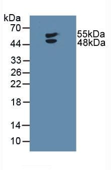 LTBR Antibody (aa66-215)