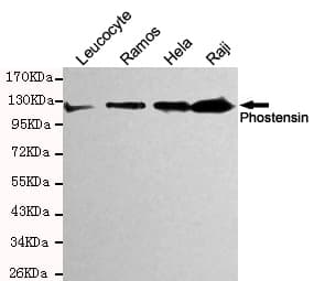 PPP1R18 Antibody