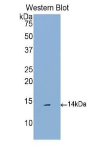 CCL16 / LEC Antibody (aa20-120, Cy3)