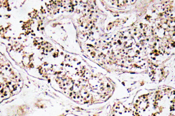 VIP Antibody (aa71-120)