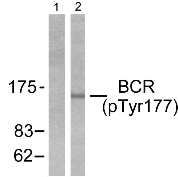 CML / BCR Antibody (phospho-Tyr177)