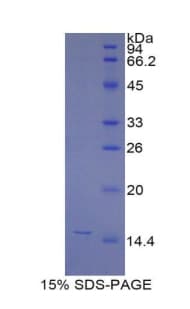 Mouse Beta-N-Acetylglucosaminidase Protein (Recombinant His)