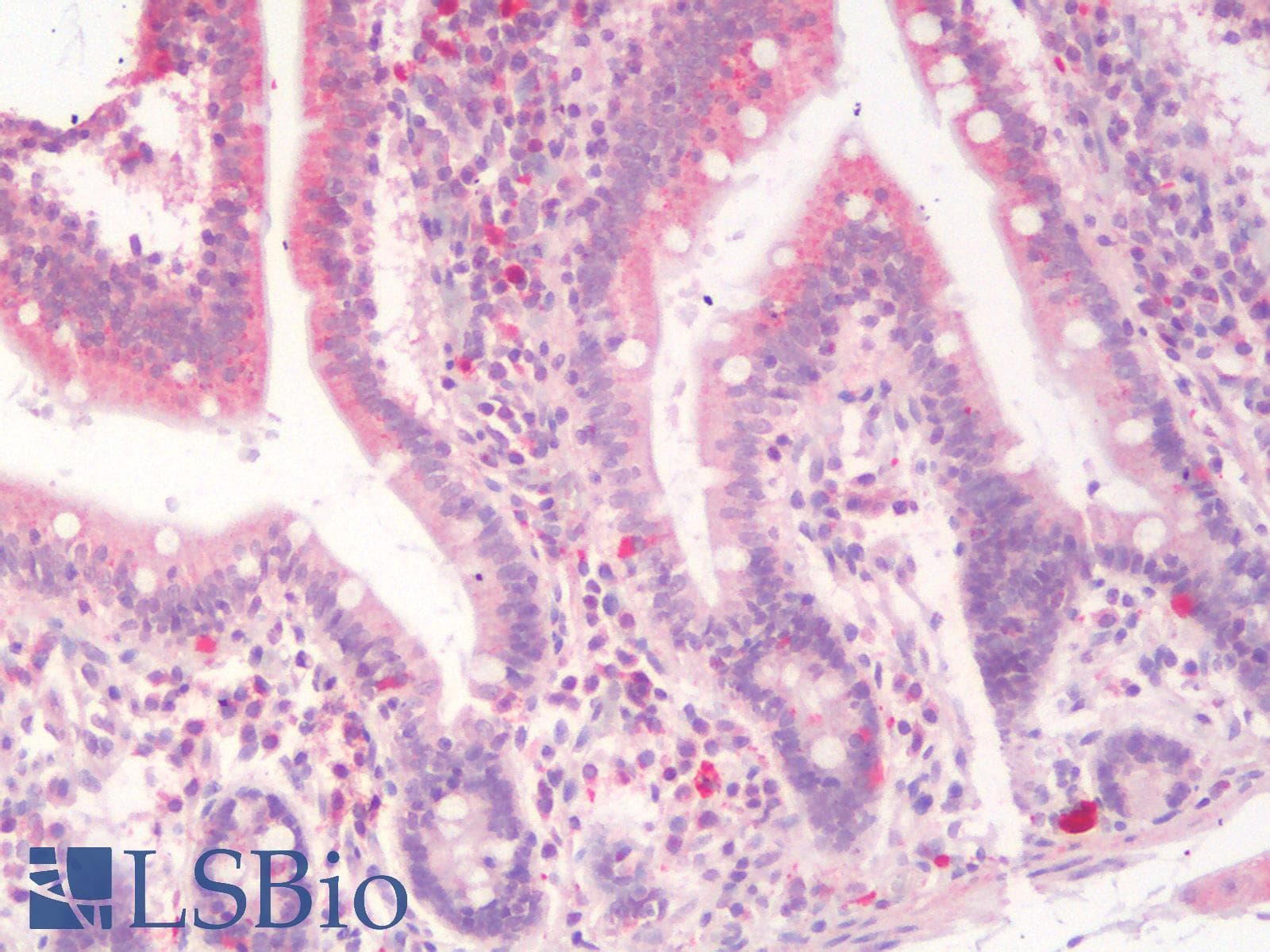 PathPlus™ SLC40A1 / Ferroportin-1 Antibody