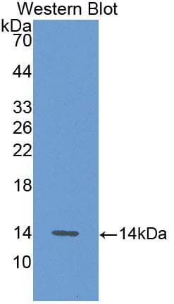 GPT / Alanine Transaminase Antibody (aa147-263, APC, Cy7)