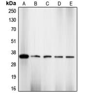 Polyclonal Rabbit anti-Human CDK2 Antibody (phospho-Thr160, IHC, WB)
